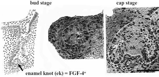 Early phases of tooth development