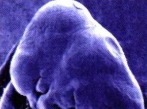Normal embryo