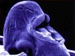Mutantní embryo