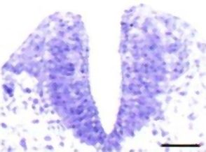 Mutant embryo