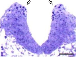 Normal embryo