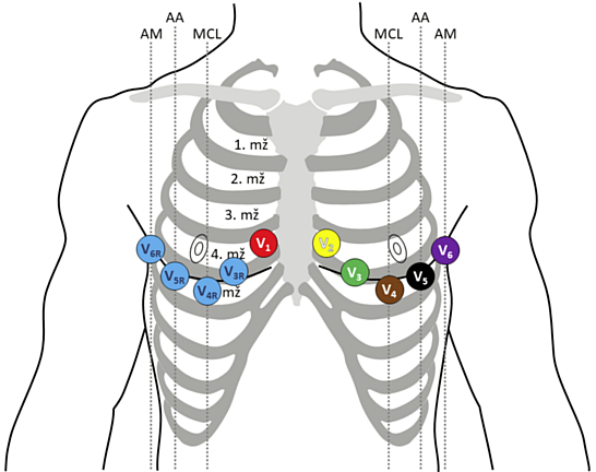 Pravostrané hrudní elektrody