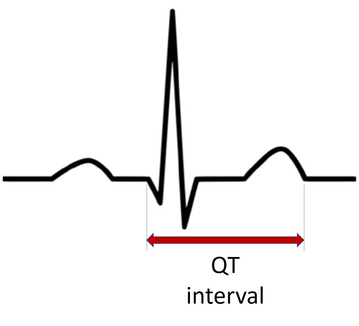 OT interval