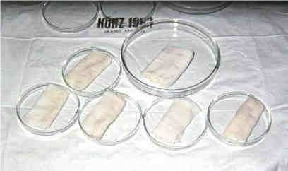 Figure 1 Split pigskin stripes on moisted gauze in a moist-chamber –Petri dish with sterile physiological saline at the bottom . Shelf life was 10 days at +4°C (picture from 1985)