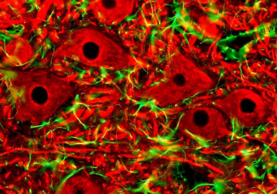 PanNF a GFPA imunohistochemie